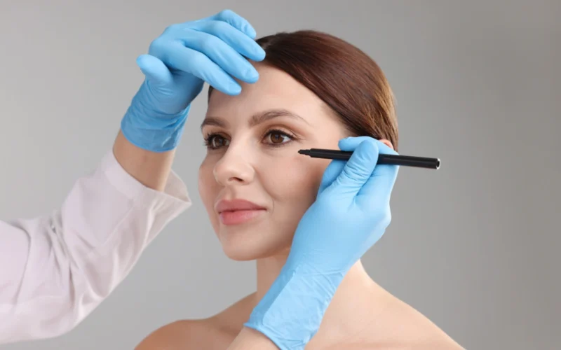 Facelift