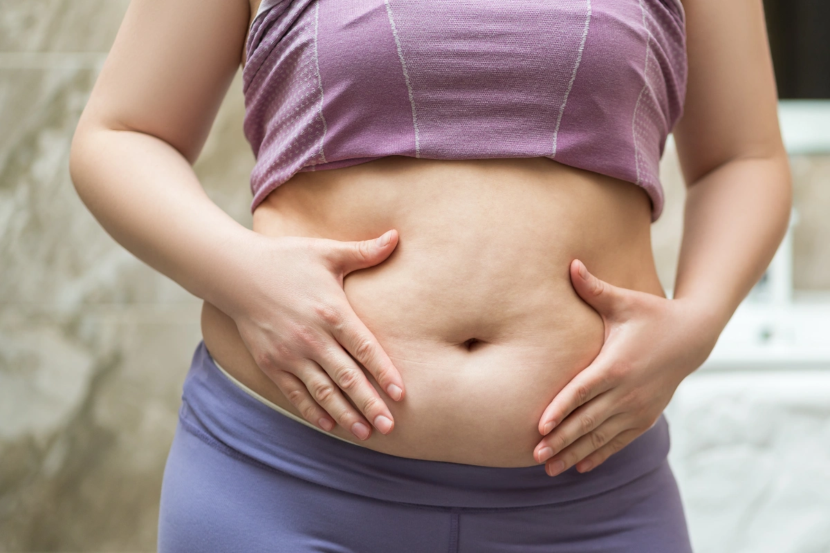 Karın Germe (Abdominoplasti)